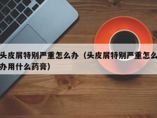 头皮屑特别严重怎么办（头皮屑特别严重怎么办用什么药膏）