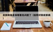 皮肤痒是身体哪里出问题了（拍照识别皮肤病）