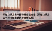 尿道口摸上去一排排锯齿状肉芽（尿道口摸上去一排排锯齿状肉芽挂什么科）