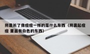 阴囊长了像痘痘一样的是什么东西（阴囊起痘痘 里面有白色的东西）